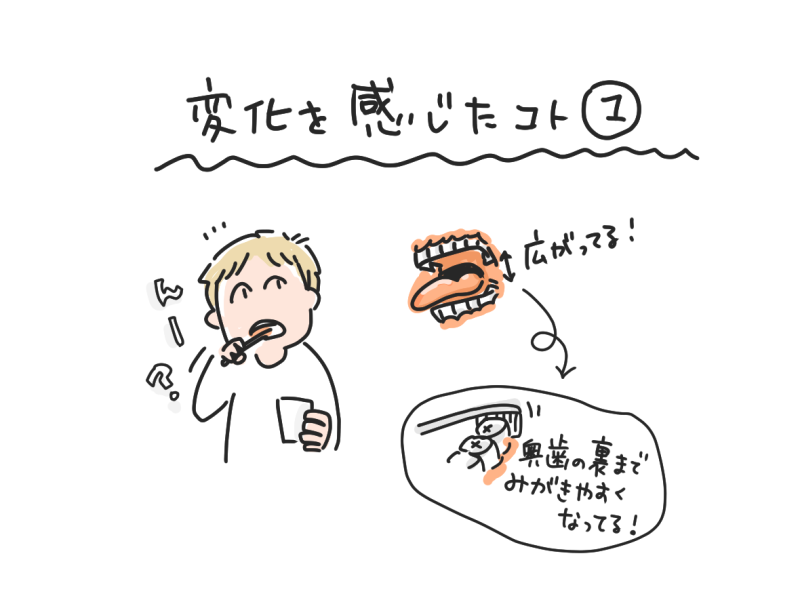 歯みがきをする人物と、大きく開いた口の図解。「奥歯の裏までみがきやすくなってる!」というコメント付き。