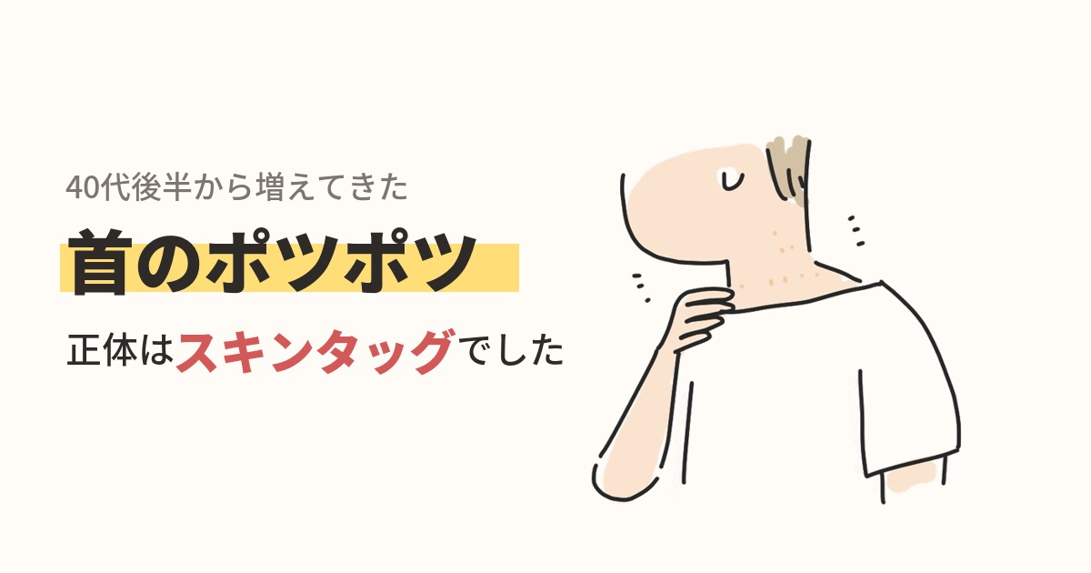 40代後半から増えてきた首のポツポツ。正体はスキンタッグでした、というタイトルと、首を触って気づいている女性のイラスト。