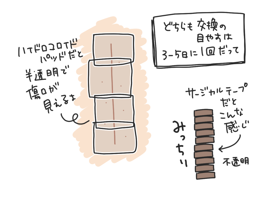 ハイドロコロイドパッドとサージカルテープの見た目のちがい。ハイドロコロイドパッドは半透明で傷口が見える、サージカルテープは不透明でみっちり。どちらも交換の目安は3〜5日に1回